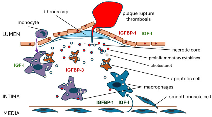 胰岛素样生长因子结合蛋白IGFBP-1